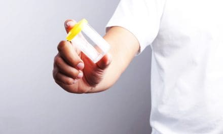Drug Testing Your Employees